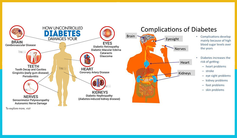 patients with uncontrolled diabetes experience polyuria