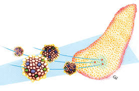 experimental diabetes cure