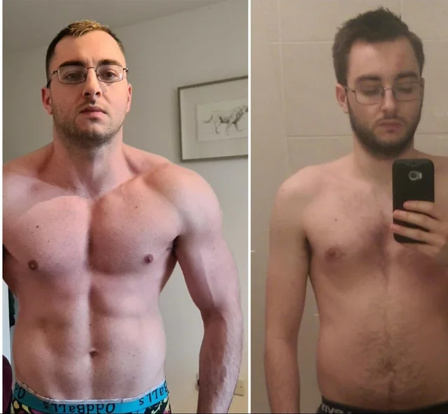 diabetes experience reddit
