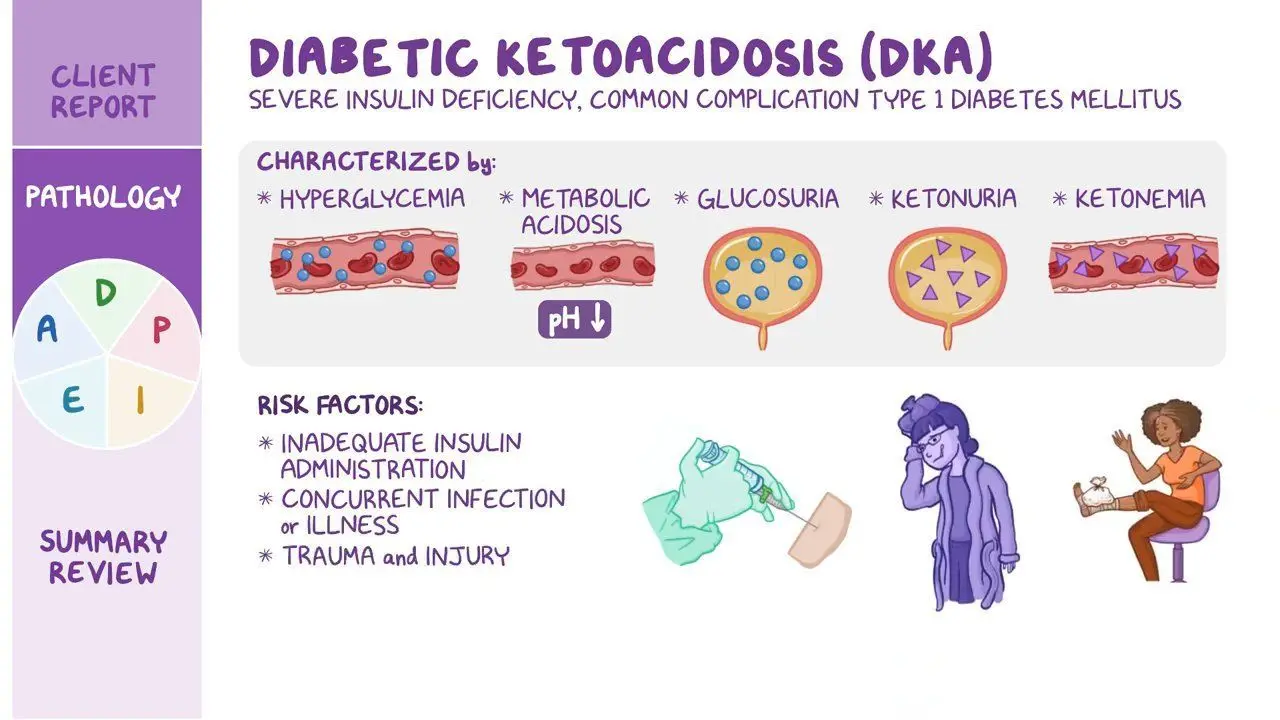 DKA Experience: Understanding the Symptoms, Causes, and How to Manage It
